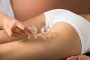 https://chirocarewellnessclinic.com/wp-content/uploads/2016/06/cupping2-300x200.jpg