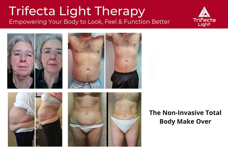 Trifecta Light Therapy Results